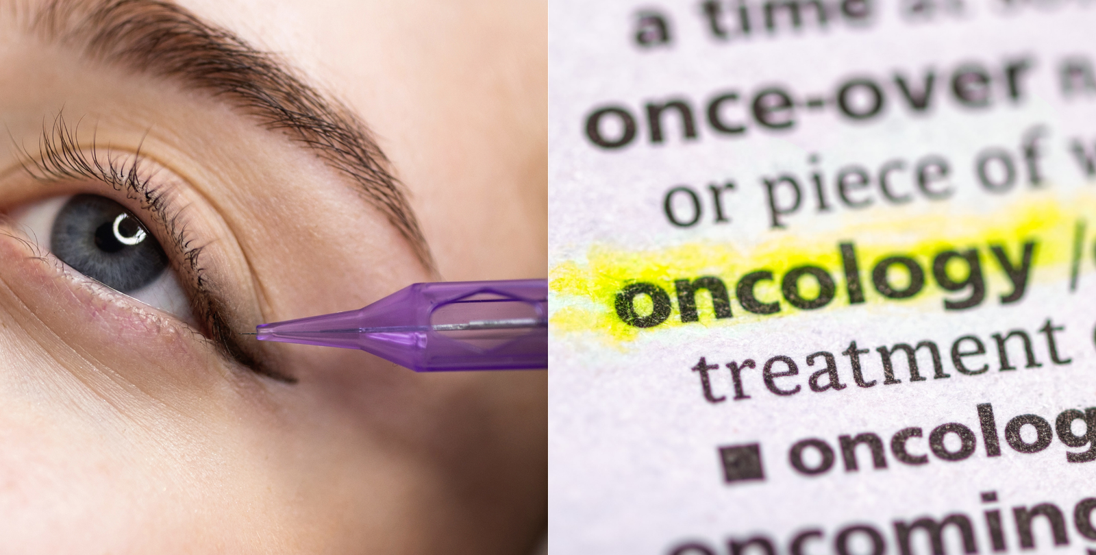 Procedimiento de micropigmentación oncológica en cejas para paciente con cáncer.